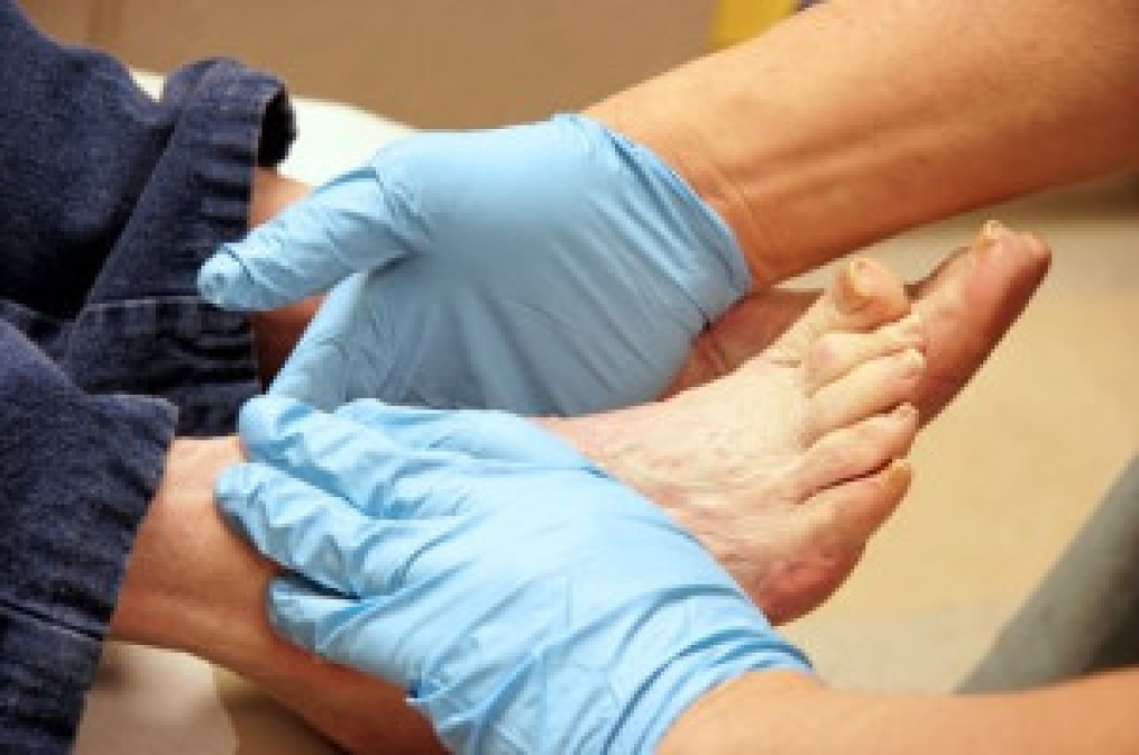 Diabetic Nerve Pain in the Feet