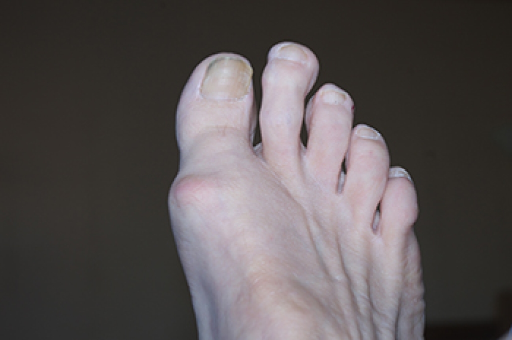 Dealing With a Longer 2nd Toe