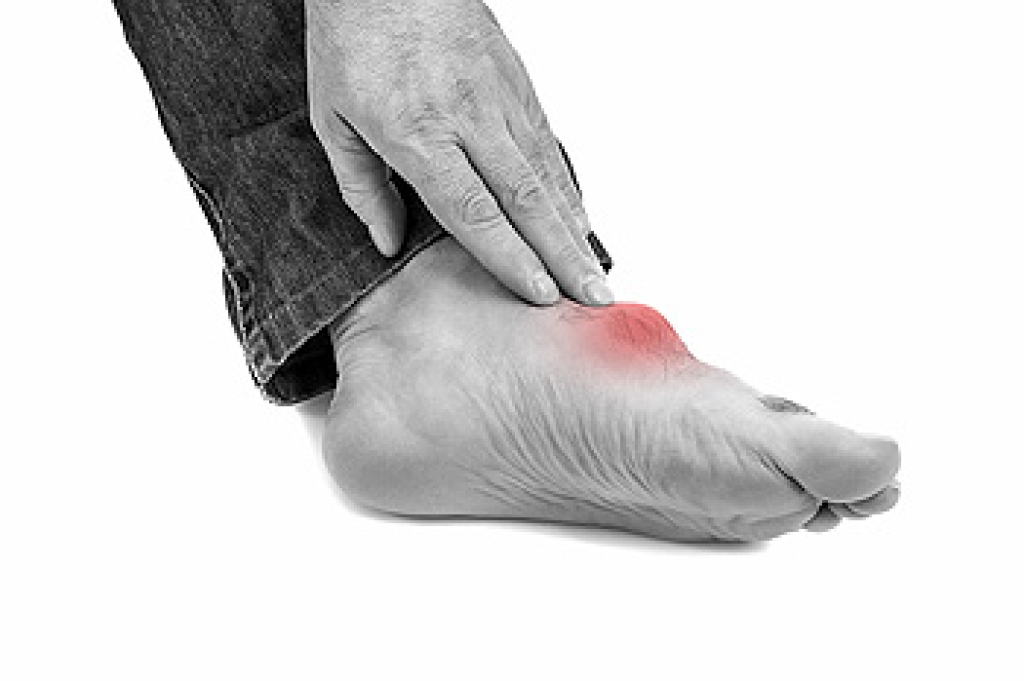 Understanding Gout and Sudden Foot Pain